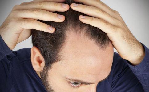 男性谢顶警惕这些疾病 几招帮你预防脱发